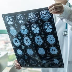 Doctor looking at ct scan results